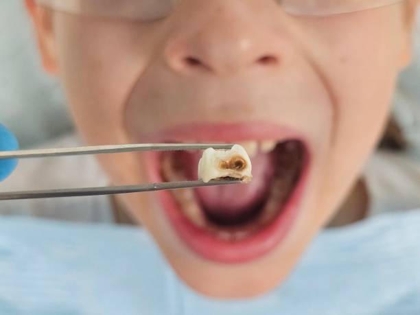 Best Urgent Dental Care  in Seco Mines, TX